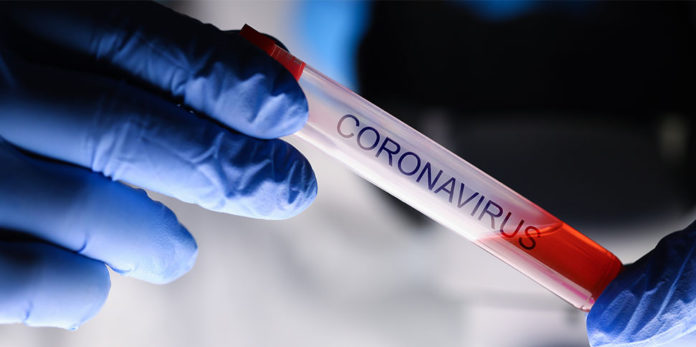 coronavirus Reagenzglas Test